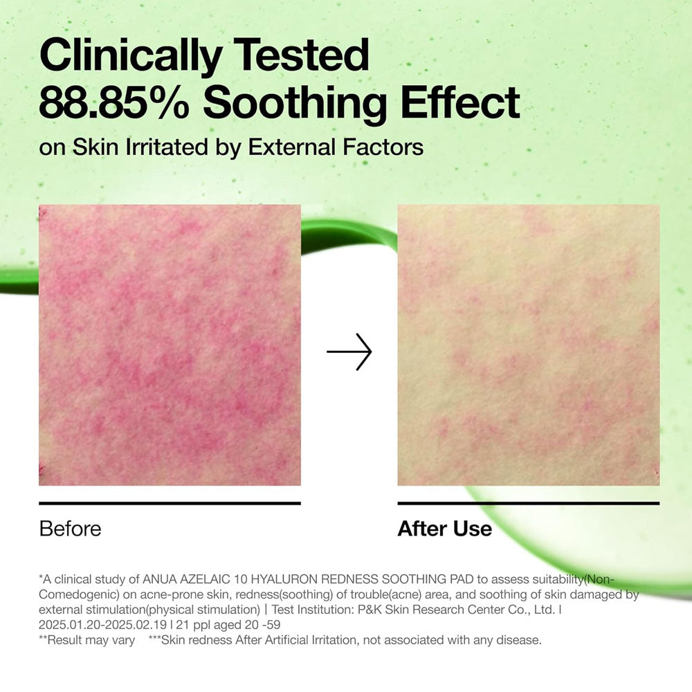Anua Azelaic 10 Hyaluron Redness Soothing Pad 90 Pads