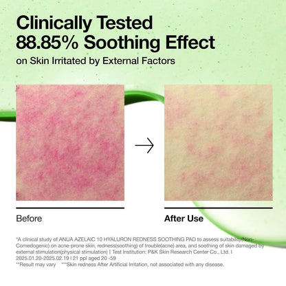 Anua Azelaic 10 Hyaluron Redness Soothing Pad 90 Pads