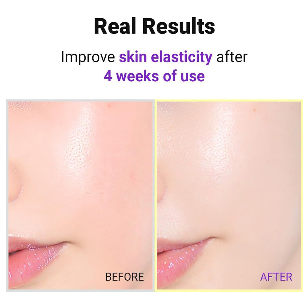 Isntree Hyper Retinol EX 1.0 Serum 20ml