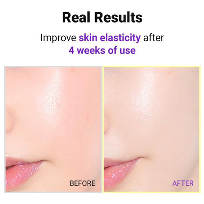 Isntree Hyper Retinol EX 1.0 Serum 20ml