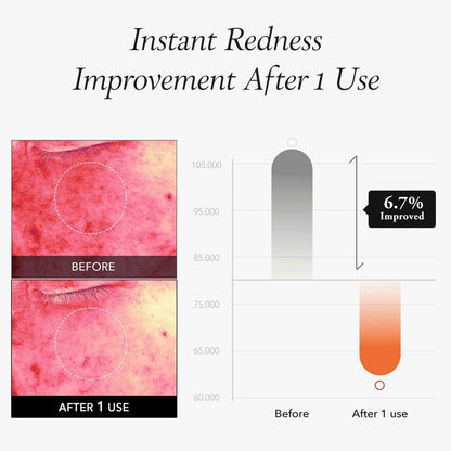APRILSKIN Carrotene IPMP Instant Calming Serum Pads (80 Pads)