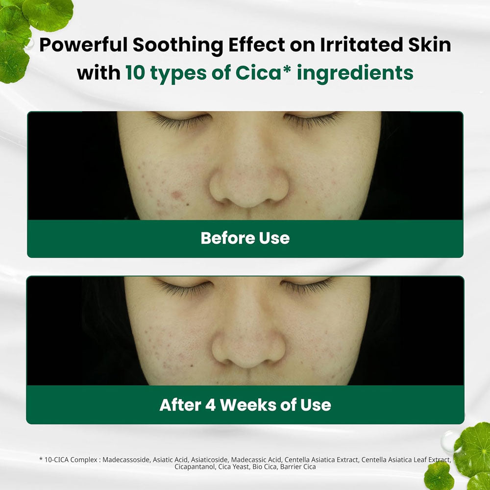 Dr.G R.E.D Blemish Clear Soothing Cream 70ml