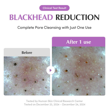 EQQUALBERRY Purple Rice Pore Purifying Pack Cleanser 130g